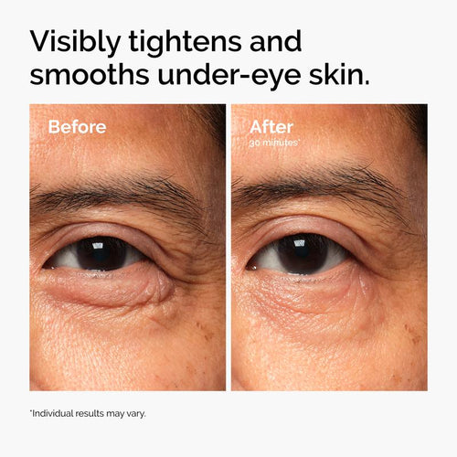 Vegan PDRN Eye Cream