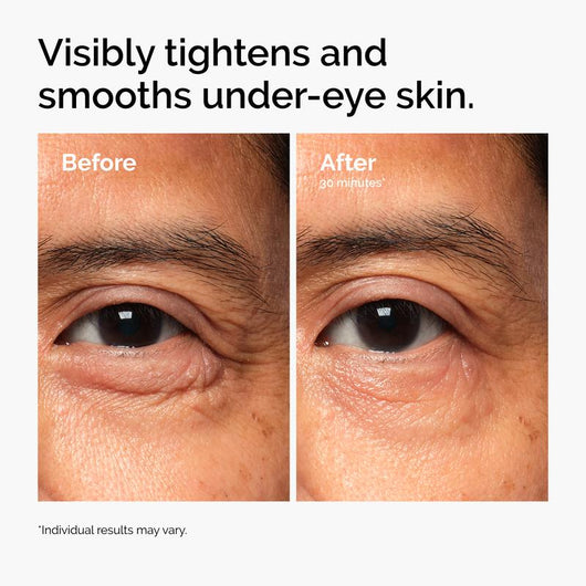 Vegan PDRN Eye Cream